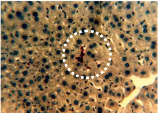 Gambar 10. Gambaran anatomi mikroskopik hati mencit  kelompok IV (kelompok mencit yang diberikan minyak  kelapa sawit yang telah dipanaskan 10X)