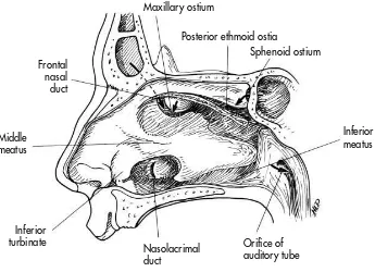 Gambar 2.1 Struktur Anatomi Dinding Nasal Lateral. Sumber : Ballenger, 2003. 