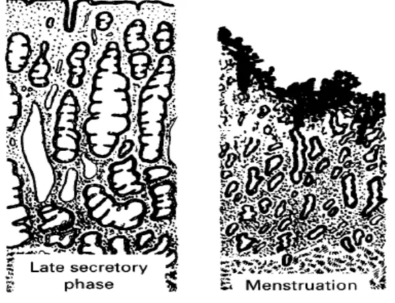 Gambar 2.5 Ilustrasi Endometrium pada Awal Fase Sekretori dan Saat Haid 