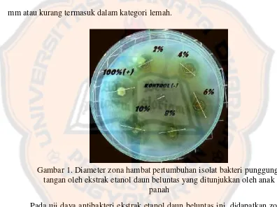 Gambar 1. Diameter zona hambat pertumbuhan isolat bakteri punggung