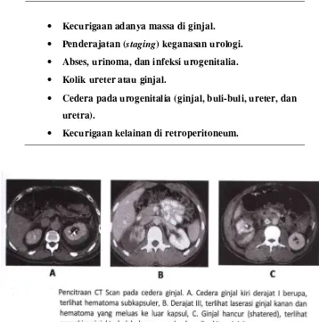 Table 2.2. Indikasi pemeriksaan CT scan pada kelainan urologi 