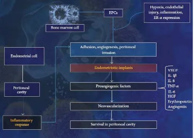 Gambar 3. Patogenesis Endometriosis30 