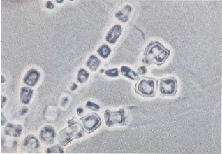 Gambar 2.27. Makroskopis Trichosporon beigelii 