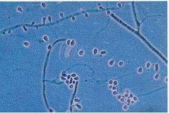 Gambar 2.9. Makroskopis Microsporum mentagrophytes 