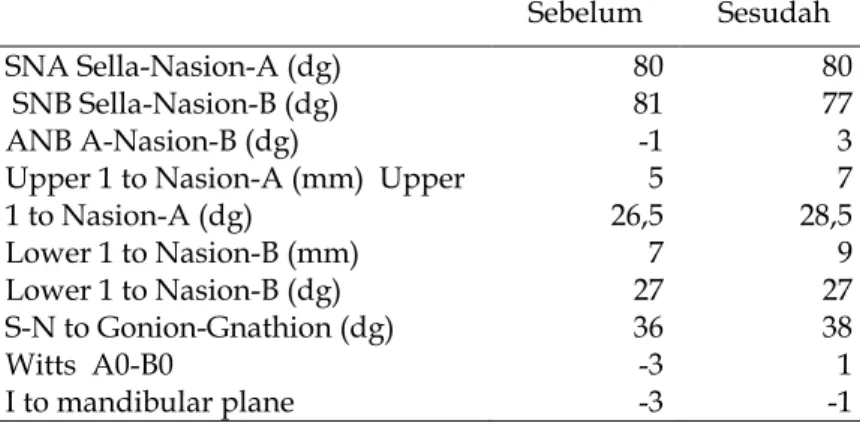 Tabel 1. Hasil Penapakan Sefalometri Pasien Sebelum dan Sesudah 8 bulan Perawatan  Sebelum  Sesudah 