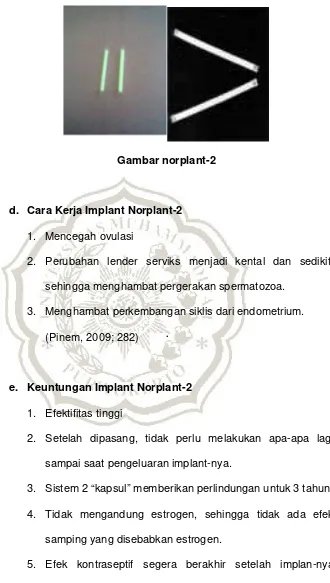 Gambar norplant-2 