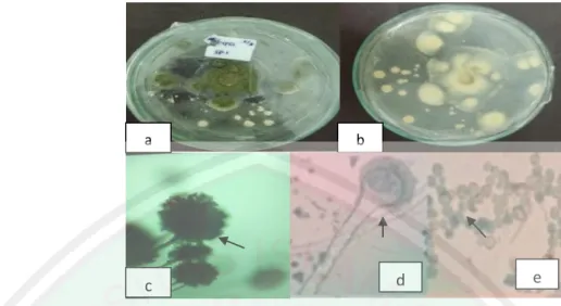 Gambar 4.2 Karakteristik dari isolat F1 (a) permukaan koloni atas (b) Permukaan  Koloni bawah, (c) Morfologi mikroskopis fungi F1 (d) kepala konidia  (e) konidia Aspergillus (Nopvita dkk, 2015)