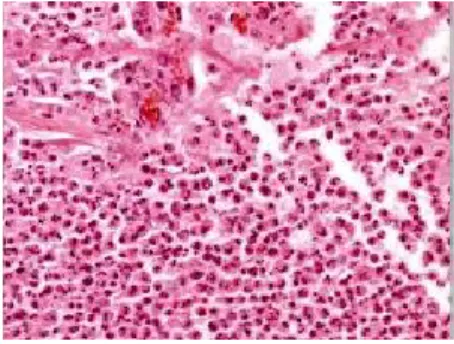 Gambar 3.  Fase proliferasidi mana jaringan granulasi  mengisi kavitas luka dan keratinosit bermigrasi untuk  menutup luka (Gutner GC, 2007) 