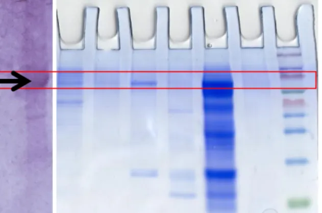 Gambar 1. Profilling Karakter Protein pada  Sampel Sel Kanker Leher rahim, Apusan Leher 
