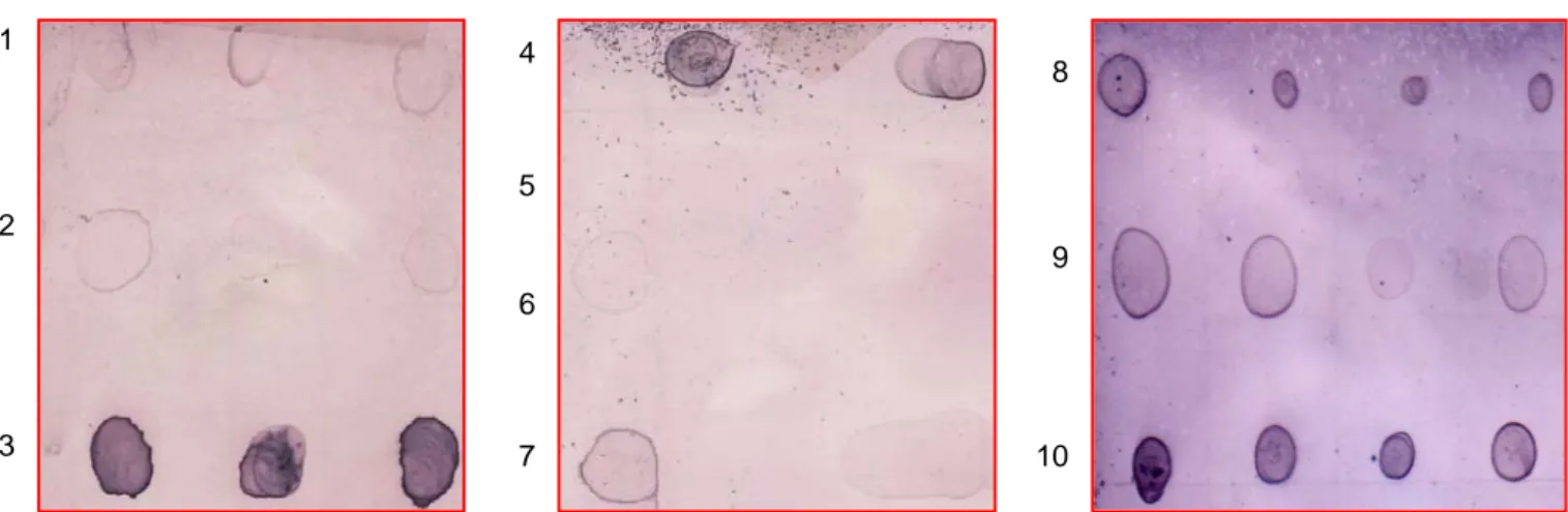 Gambar 5.  Hasil deteksi toksin Photorhabdus spp. isolat HJ dibandingkan dengan Ag  Xoo, Xcg, Rs, dan Psg E