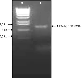 Gambar 2.  Hasil elektroforesis agarose gel produk PCR 16S rDNA bakteri  merah. M = marker DNA 1 kb, 1 = 16S rRNA bakteri merah