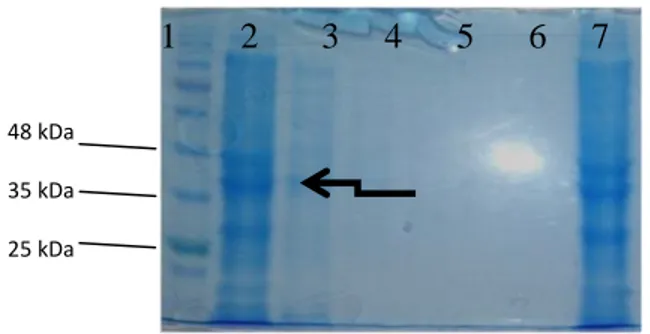 Gambar  1.  Hasil  Identifikasi  Bakteri.  (a)  Pengecatan  Gram  dilihat  dengan  mikroskop  perbesaran  1000x  yang  menunjukkan  bakteri  berwarna  merah  dan  berbentuk  batang pendek; (b) Lingkaran menunjukkan koloni mukoid  pada kultur pada media Mac
