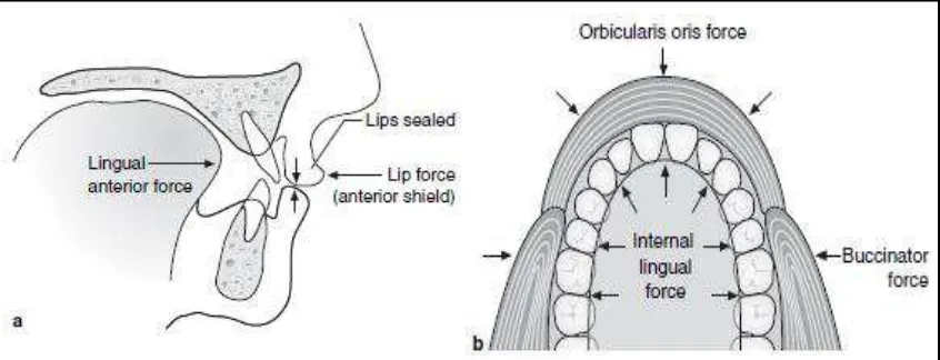 Gambar 1. Posisi istirahat lidah menyebabkan tekanan internal dan eksternal terhadap Gigi-geligi menjadi seimbang sehingga memicu perkembangan normal regio dental alveolar.23 