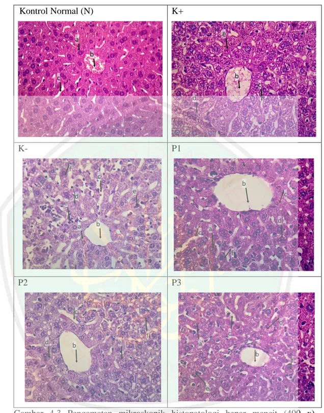 Gambar  4.3  Pengamatan  mikroskopik  histopatologi  hepar  mencit  (400  x),  keterangan:  (a)  hepatosit  normal,  (b)  vena  sentral,  (c)  sinusoid,  (d)  degenerasi  hidropik, (e) nekrosis, (f) degenerasi parenkimatosa