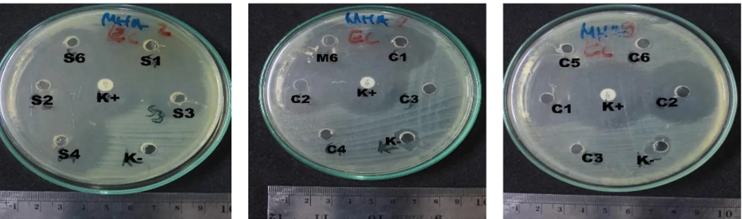 Gambar 2 Zona hambat yang terbentuk pada bakteri uji S. aureus. 