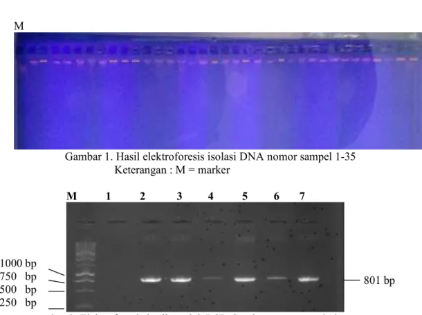Gambar 1. Hasil elektroforesis isolasi DNA nomor sampel 1-35                                             Keterangan : M = marker 