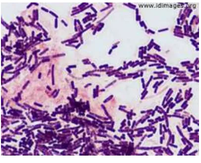 Gambar 2.3.Bacillus cereus 
