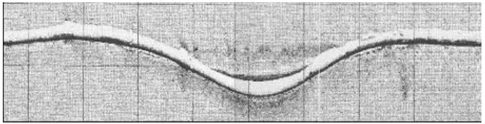 Gambar I-3 Ilustrasi lateral buckling (Bruton, 2003) 