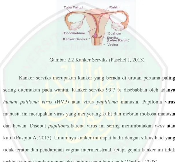 Gambar 2.2 Kanker Serviks (Paschel J, 2013) 