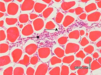 Gambar 3 Gambaran histopatologik otot broiler  kelompok enrofloksasin hari ke-5  ter-lihat infiltrasi sel heterofil dan sel  limfosit diantara bundel otot, struktur  serabut otot normal