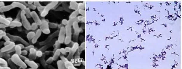 Gambar 2.8 Proponibacterium acnes: (a) pada mikroskop elektron, (b) pada 