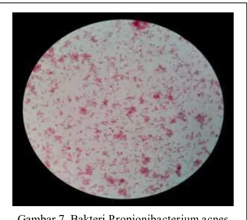 Gambar 7. Bakteri Propionibacterium acnes 