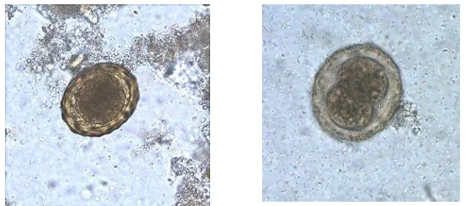 Gambar 2.1 Telur Ascaris lumbricoides fertilized 