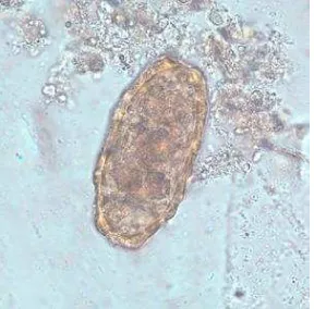 Gambar 2.2 Telur Ascaris lumbricoides unfertilized 