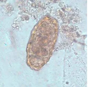 Gambar 2.2 Telur Ascaris lumbricoides unfertilized 