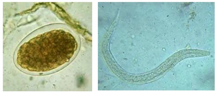 Gambar 2.4. Telur dan Larva Hookworm 