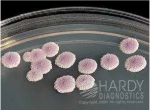 Gambar 2.1.Candida albicans. A: Blastokonidia (blastospora) dan pseudohifa dalam eksudat