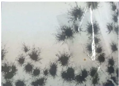 Gambar 2.5. Fotomikrografi dari kultur  Candida parapsilosis pada agar cornmeal, menyerupai “spider colonies” dengan serabut Sumber: Winn et al