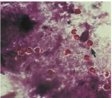 Gambar  2.3  Gambaran  mikroskopis  dari  ookista  Cryptosporidium  sp.  dengan  perbesaran  400x  menggunakan  pewarnaan  modifikasi  tahan  asam