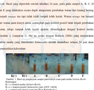 Gambar  1. Hasil uji pengkayaan sampel jamu kunyit asam pada media Selenite Broth 