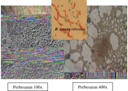 Gambar 1 Koloni Bacillus cereus di bawah pengamatan mikroskop  perbesaran 100x dan 400x pada media MYP 