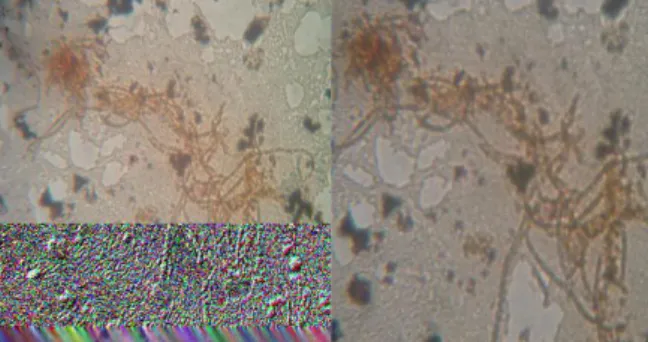 Gambar 4  Perubahan warna hitam (a), kuning (b) dan merah (c)  pada media TSIAA akibat pertumbuhan Salmonella   Perubahan  tersebut  menurut 