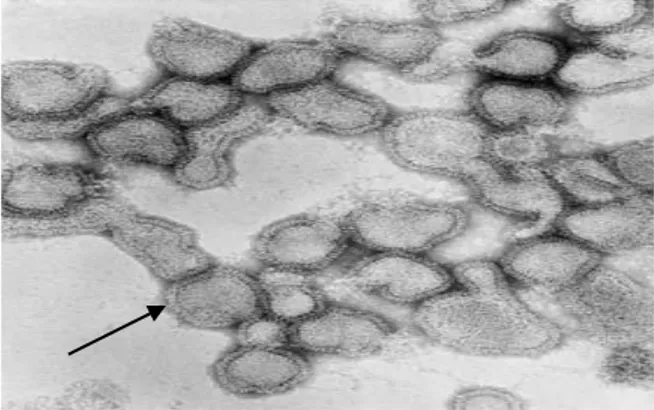 Gambar 1. Partikel virus influenza berbentuk pleomorfik dan  terdapat  spike  pada  lapisan  permukaan  yaitu  hemaglutinin  dan  neuraminidase  serta  berdiameter 80-120 nm 