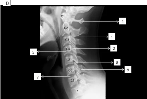 Gambar 6. Radioanatomi pada radiografi vertebra cervikal posisi oblik B 