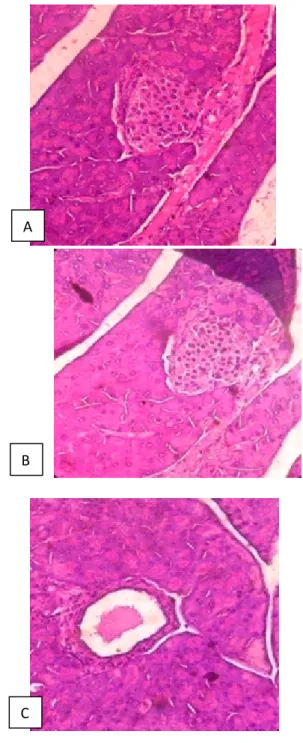 Gambar  2.    Penampang  melintang  struktur  pankreas  setelah  pemberian  seduhan  kayu  manis  pada  mencit  setelah  pemaparan aloksan perbesaran 400x 