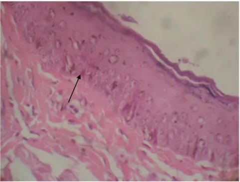 Gambar 7. Epitel nasofaring normal. Tampak proliferasi sel masih dalam batas  normal. Tidak tampak adanya hiperplasia atau displasia
