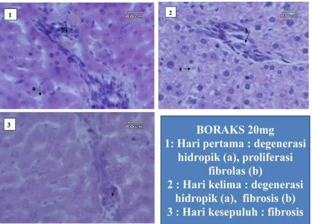 Gambar 5. Gambaran Mikroskopik Hati Tikus Wistar Kelompok 2 yang diberikan boraks 20 mg 