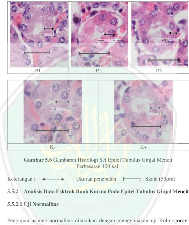 Gambar 5.6 Gambaran Histologi Sel Epitel Tubulus Ginjal Mencit  Perbesaran 400 kali 