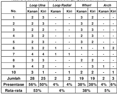 Tabel 1. Distribusi frekuensi pola sidik jari pada penderita Sindrom Down  Loop Ulna  Loop Radial  Whorl  Arch  No