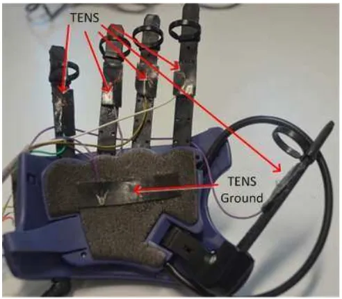 Gambar 7. Glove dengan TENS elektroda dibagian dalamnya 