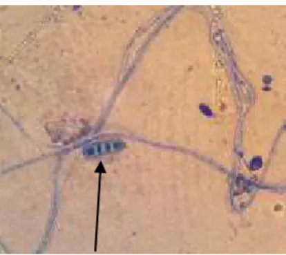Gambar 11. Konidia Bipolaris sp. (perbesaran 400x)  Dari  hasil  pengamatan    mikroskopis 