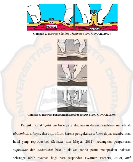Gambar 2. Ilustrasi Skinfold Thickness (TNC-CDAAR, 2003)