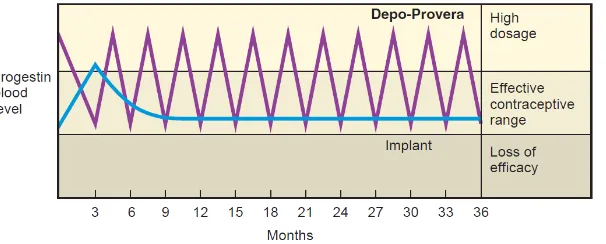 Gambar 2.5. Perbedaan Kadar Serum Progestin pada Penggunaan Depo-Provera dan Implant. Sumber: Fritz, M.A & Speroff, L., 2011