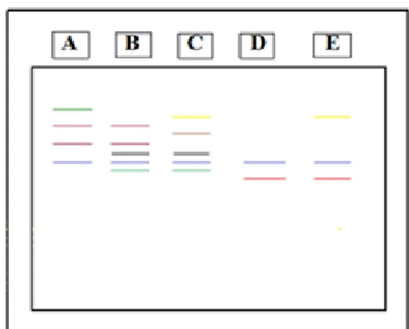 Gambar 2 Zimogram morfologi kualitatif 5  jenis salak Padang Sidempuan yaitu A) Sisu ndung1 B) Sisundung2 C) Sisundung3 D) Si sundung4 E) Sisundung5 