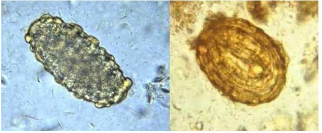 Gambar 2.3 Telur cacing Ascaris lumbricoides. (a) telur yang tidak dibuahi, (b) telur yang dibuahi  (PHIL 411/4821 - CDC/Dr