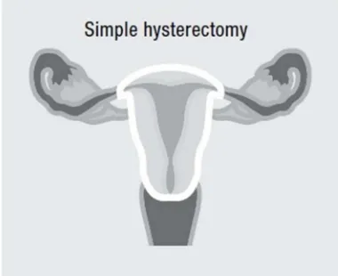 Gambar 2.11 Gambaran Simpel Histerektomi (sumber : WHO cervical cancer control, 2006) 
